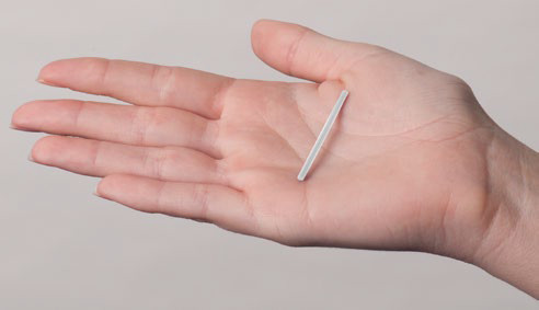 Contraceptive implant in hand