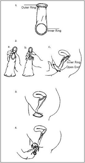 using the female condom Best sexy video clips