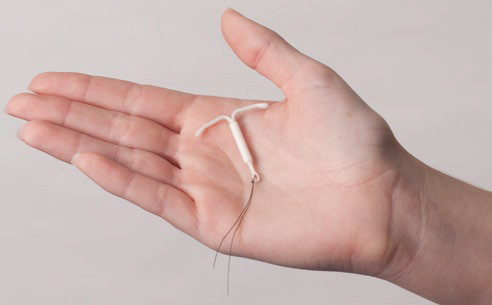 Mirena IUD on hand